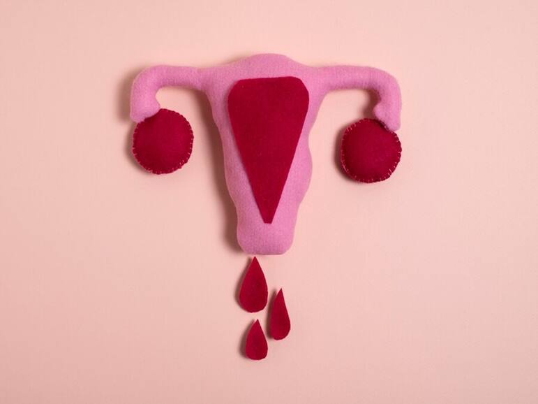 High Estrogen Alert: 7 Symptoms That Could Signal A Hormonal Imbalance