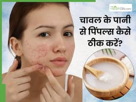 Rice Water for Pimples: चेहरे से पिंपल्स मिटाने के लिए इन 5 तरीकों से इस्तेमाल करें चावल का पानी, दूर हो जाएगी समस्या