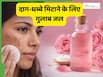 दाग-धब्बे कम करने के लिए गुलाब जल कैसे लगाएं? 3 तरीकों से मिल सकता है फायदा