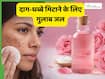 दाग-धब्बे कम करने के लिए गुलाब जल कैसे लगाएं? 3 तरीकों से मिल सकता है फायदा