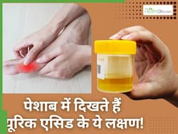 सुबह-सुबह पेशाब में दिखते हैं हाई यूरिक एसिड के ये 4 लक्षण, तीसरे वाले को इग्नोर करने से बढ़ सकती है परेशानी