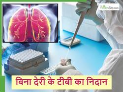 Tuberculosis: टीबी के निदान में देरी नहीं होने देगी ये नई टेस्टिंग तकनीक, एक्सपर्ट्स से जानिए इस खास मेथड के बारे में।
