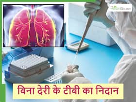 Tuberculosis: टीबी के निदान में देरी नहीं होने देगी ये नई टेस्टिंग तकनीक, एक्सपर्ट्स से जानिए इस खास मेथड के बारे में। Tuberculosis: टीबी के निदान में देरी नहीं होने देगी ये नई टेस्टिंग तकनीक, एक्सपर्ट्स से जानिए इस खास मेथड के बारे में।