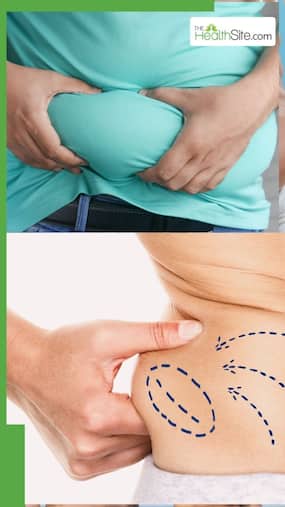 पेट और कूल्हों की चर्बी कैसे कम करें?