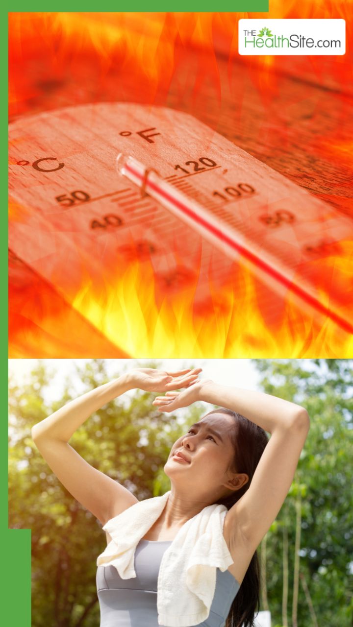 हीट स्ट्रोक और गर्मी से जुड़ी परेशानी का इलाज कैसे करें?