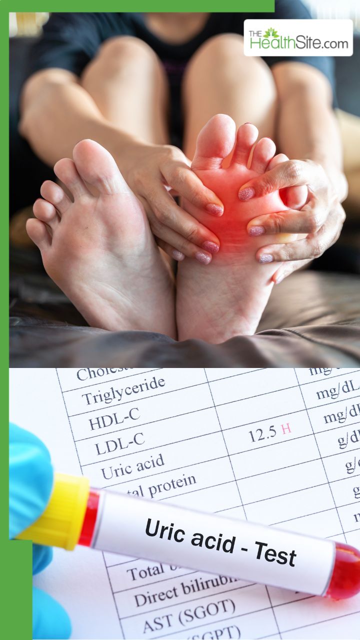 कौन सी दाल खाने से यूरिक एसिड बढ़ता है