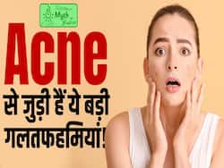 पिम्पल्स को लेकर इस बात पर ना करें भरोसा, देखें ये वीडियो