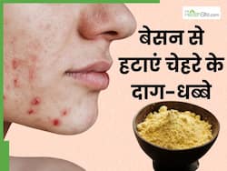 बेसन से चेहरे के दाग-धब्बे कैसे कम होंगे? जानिए चेहरे पर बेसन लगाने का सही तरीका