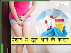 рдкреЗрд╢рд╛рдм рдореЗрдВ рдЦреВрди рдЖрдирд╛ рд╣реИ рдЗрди 5 рдмреАрдорд╛рд░рд┐рдпреЛрдВ рдХрд╛ рд▓рдХреНрд╖рдг, рдпреЗ рд╡рд╛рд▓реА рдмреАрдорд╛рд░реА рддреЛ рдмрд░рд╕реЛрдВ рддрдХ рд░рд╣рддреА рд╣реИ рдЫреБрдкреА рд╣реБрдИ