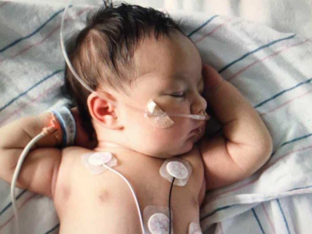 Congenital Heart Disease In Babies