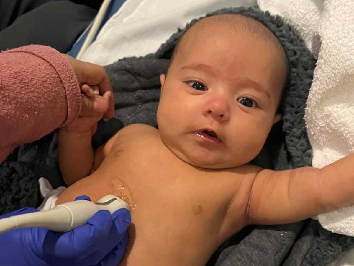 Congenital Heart Disease