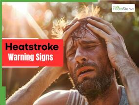 Heatstroke Symptoms: 7 Warning Signs Your Body Shows Before a Deadly Heatwave-Induced Stroke Strikes