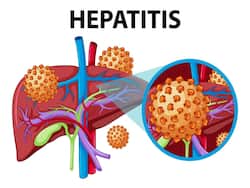 More Than 100 Hepatitis A Cases Recorded In Ernakulum, Kerala: Department Of Health