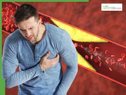 High Cholesterol Symptoms: 5 Warning Indicators Your Body Sends When LDL Levels Are Too High