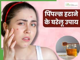 चेहरे से अनचाहे पिंपल्स को हटाने के लिए आजमाएं ये 5 घरेलू उपाय, दाग-धब्बों से मिलेगा छुटकारा