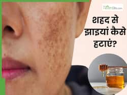 शहद से झाइयां कैसे हटाएं? जानें 5 तरीके, जिनसे दूर होंगे दाग-धब्बे और कालापन