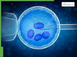 Myth Or Fact: Can Undergoing IVF Procedure Trigger An Early Menopause?