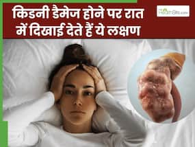 रात में नजर आते हैं किडनी डैमेज होने के ये 5 लक्षण, अधिकतर लोग साधारण समझकर करते हैं इग्नोर रात में नजर आते हैं किडनी डैमेज होने के ये 5 लक्षण, अधिकतर लोग साधारण समझकर करते हैं इग्नोर
