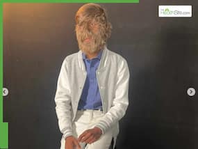 Guinness World Records: Meet Lalit Patidar, An 18-Year-Old With The Hairiest Face In The World