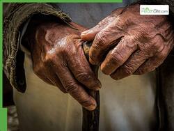 Leprosy Cases Spiked In Chennai's Migrant Workers: Causes And How It Spreads