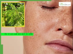 गर्मियों में 1 बार इस तरह लगाकर देखें नीम का पेस्ट, चेहरे के सारे दाग-धब्बे हो जाएंगे दूर