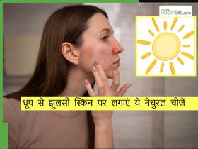 धूप में रहने के बाद घर लौटते ही चेहरे पर लगाएं ये 5 चीजें, गर्मियों में भी काला नहीं पड़ेगा चेहरा
