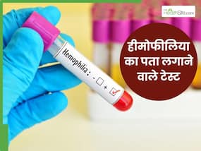 हीमोफीलिया का पता लगाने के लिए कौन से टेस्ट किए जाते हैं? जानिए पूरा प्रोसेस और कीमत