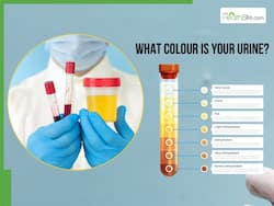 Urine Colour Chart: What the Shade of Your Pee Reveals About Your Health     Expert Insights You Shouldn   t Ignore