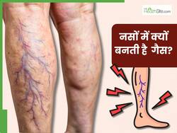 इन 5 कारणों से नसों में बनने लगती है गैस, शरीर के अंग-अंग में होने लगता है दर्द