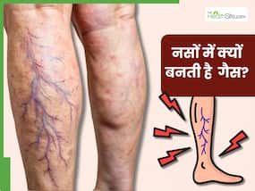 इन 5 कारणों से नसों में बनने लगती है गैस, शरीर के अंग-अंग में होने लगता है दर्द