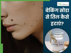 बेकिंग सोडा से तिल कैसे हटाएं? इन 5 उपायों से मिट जाएंगे सारे काले तिल और मस्से बेकिंग सोडा से तिल कैसे हटाएं? इन 5 उपायों से मिट जाएंगे सारे काले तिल और मस्से