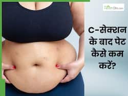 C-section डिलीवरी के बाद पेट कैसे कम करें? जानिए 3 सबसे आसान और प्रभावी तरीके