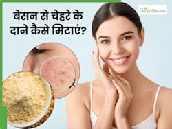 गर्मी में बेसन से चेहरे के दाने कैसे मिटाएं? जानें 5 तरीके, जिनसे मिलेगी ठंडक और चिपचिपाहट होगी दूर
