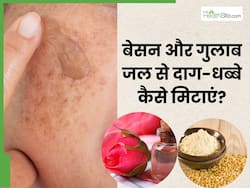 चेहरे के दाग-धब्बे मिटाने के लिए इन 5 तरीकों से लगाएं बेसन और गुलाब जल, दूर होगी समस्या