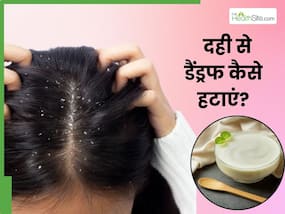 दही से डैंड्रफ कैसे हटाएं? जानें 5 तरीके, जिनसे मिट जाएगी रूसी और दूर होगी खुजली की समस्या