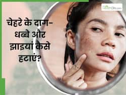 चेहरे के दाग-धब्बे और झाइयां मिटाने के लिए क्या करें? अपनाएं ये 5 उपाय तो दूर होगी समस्या