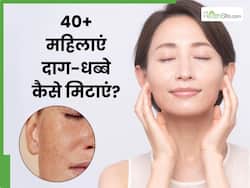 40+ महिलाएं चेहरे के दाग-धब्बे मिटाने के लिए क्या लगाएं? जानें 5 चीजें, जिनसे मिट जाएंगे सारे Dark Spots