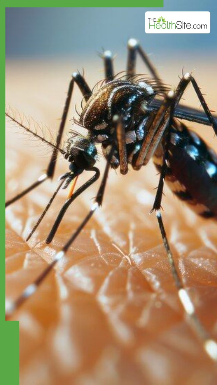 3 तरह के डेंगू फीवर और उनके लक्षण