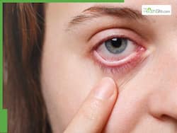 What Is An Eye Stroke: Know About Its Causes, Symptoms, Prevention Methods Amid Hot Weather Conditions