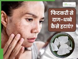 फिटकरी से दाग-धब्बे कैसे हटाएं? इन 5 तरीकों से मिट जाएंगे सारे Dark Spots