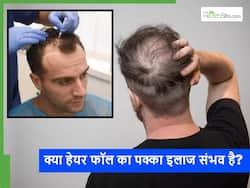 क्या किसी भी इलाज से पूरी तरह बंद हो सकता है Hair Fall? एक्सपर्ट ने बताया क्या है इसके पीछे की सच्चाई