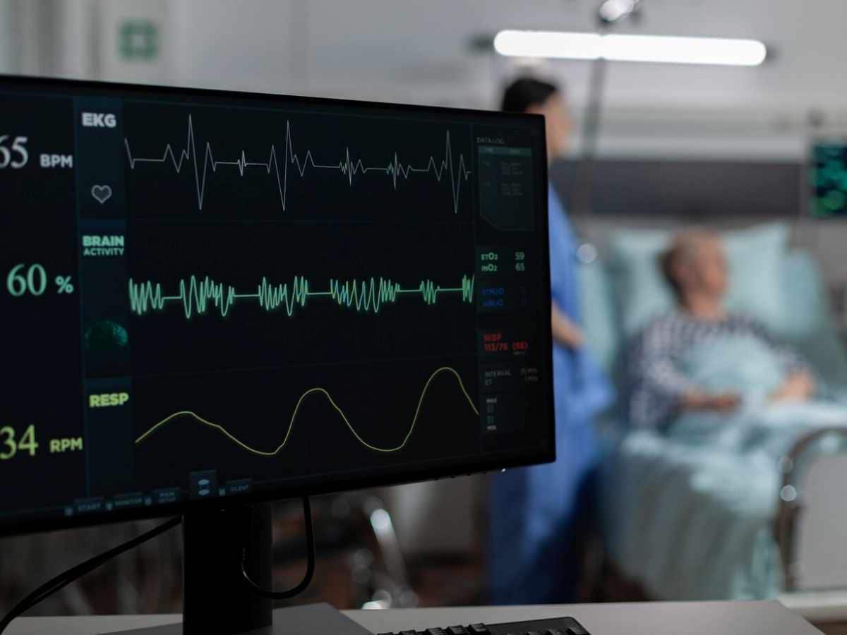 Heart rate, Syncope, Heart patients, case study, medical case, Pacemaker, Low Heart Rate, blood platelet count, coronary angiography, pacemaker implantation., life threatening health condition, elderly patient, bedridden elderly patient, case study heart patient