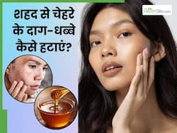 चेहरे के दाग-धब्बे मिटाने के लिए शहद कैसे लगाएं? जानें 5 तरीके, जिनसे बिल्कुल साफ हो जाएगी स्किन