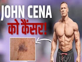 John Cena को हुआ स्किन कैंसर! जानें क्यों जरूरी है सनस्क्रीन लगाना