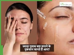 रोज गुलाब जल लगाने वाले सावधान, अगर इतने से ज्यादा लगाएंगे तो स्किन में होने लगेंगे ये नुकसान