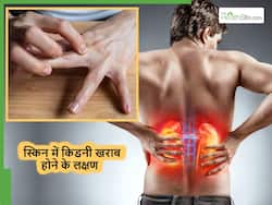 स्किन में देखे जाने वाले ये 5 लक्षण हो सकते हैं खराब किडनी का संकेत, ज्यादातर लोग कर देते हैं इग्नोर