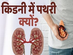 किडनी में पथरी होने के पीछे ये है कारण, देखें पूरी वीडियो
