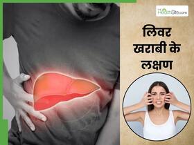 लिवर खराब होने पर चेहरे पर दिखते हैं ये 4 लक्षण, संकेत नजर आते ही तुरंत भागे डॉक्टर के पास