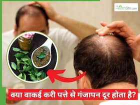 क्या वाकई करी पत्ते से गंजापन दूर होता है? जानिए करी पत्ते का हेयरमास्क बनाने का तरीका और समय