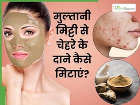 गर्मी में चेहरे के दाने मिटाने के लिए मुल्तानी मिट्टी कैसे लगाएं? इन 5 तरीकों से करें इस्तेमाल और पाएं साफ स्किन